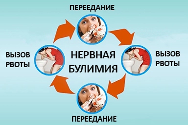 Лечение булимии в Александровске